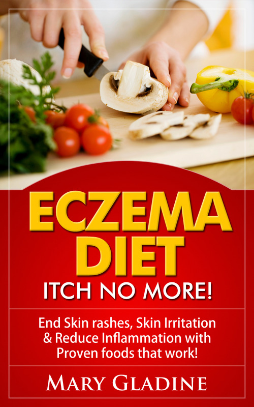 Product picture Eczema Diet: Itch No More! End Skin rashes, Skin Irritation